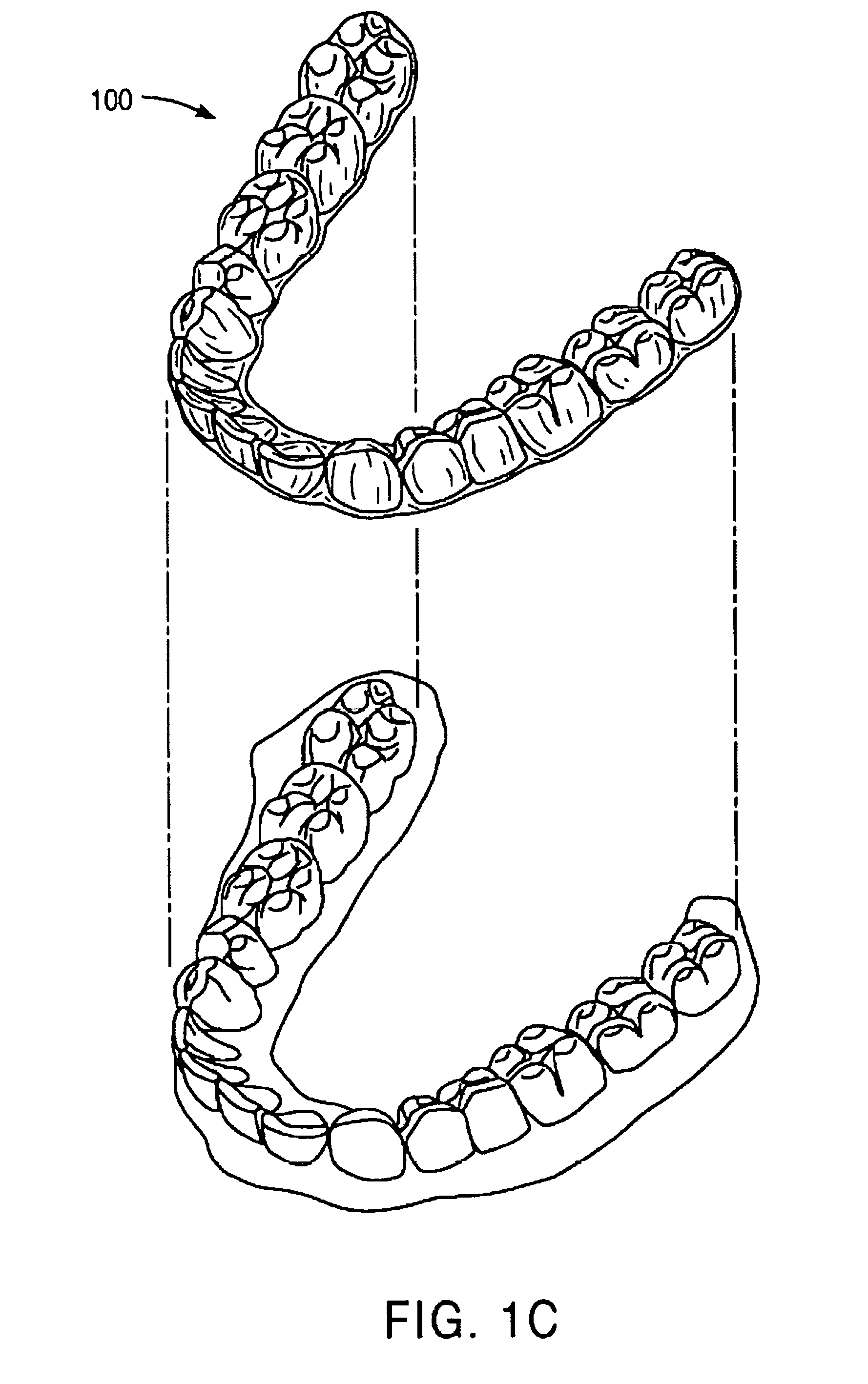 Methods and systems for lubricating dental appliances