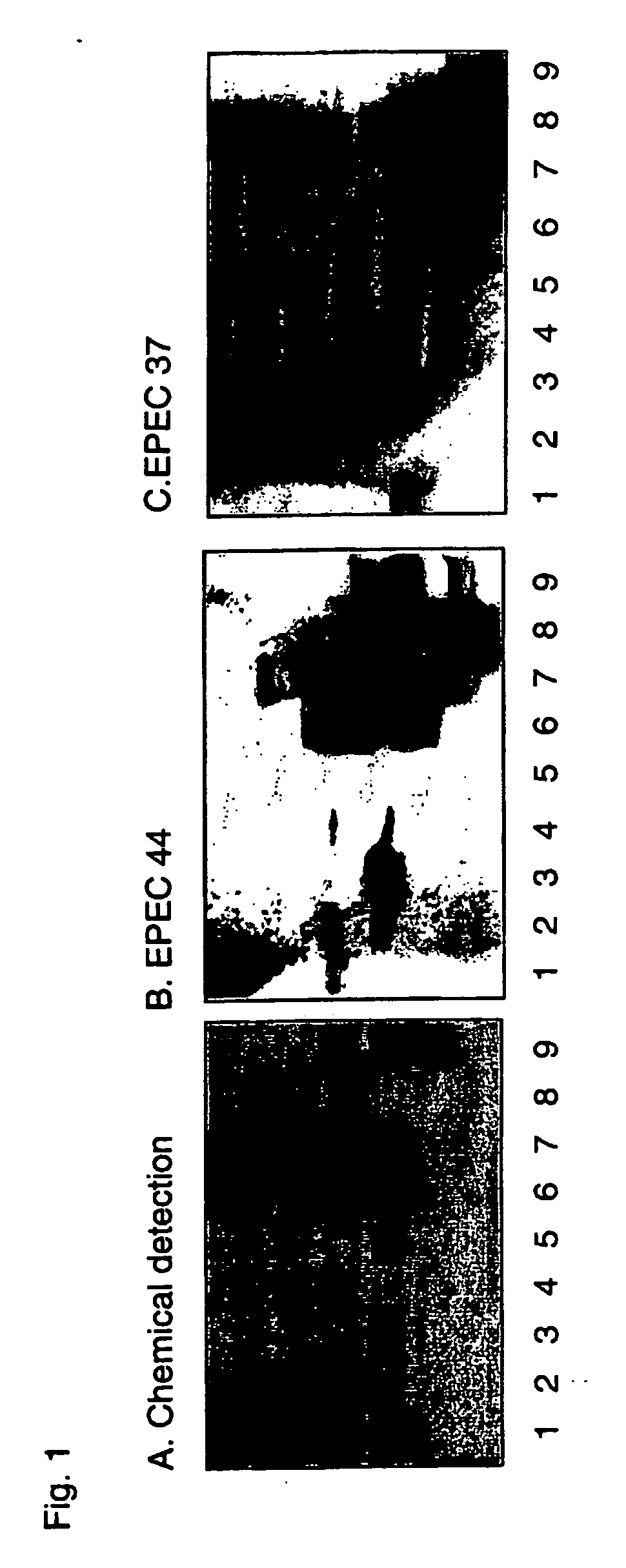 Therapeutic compositions for use in prophylaxis or treatment of diarrheas