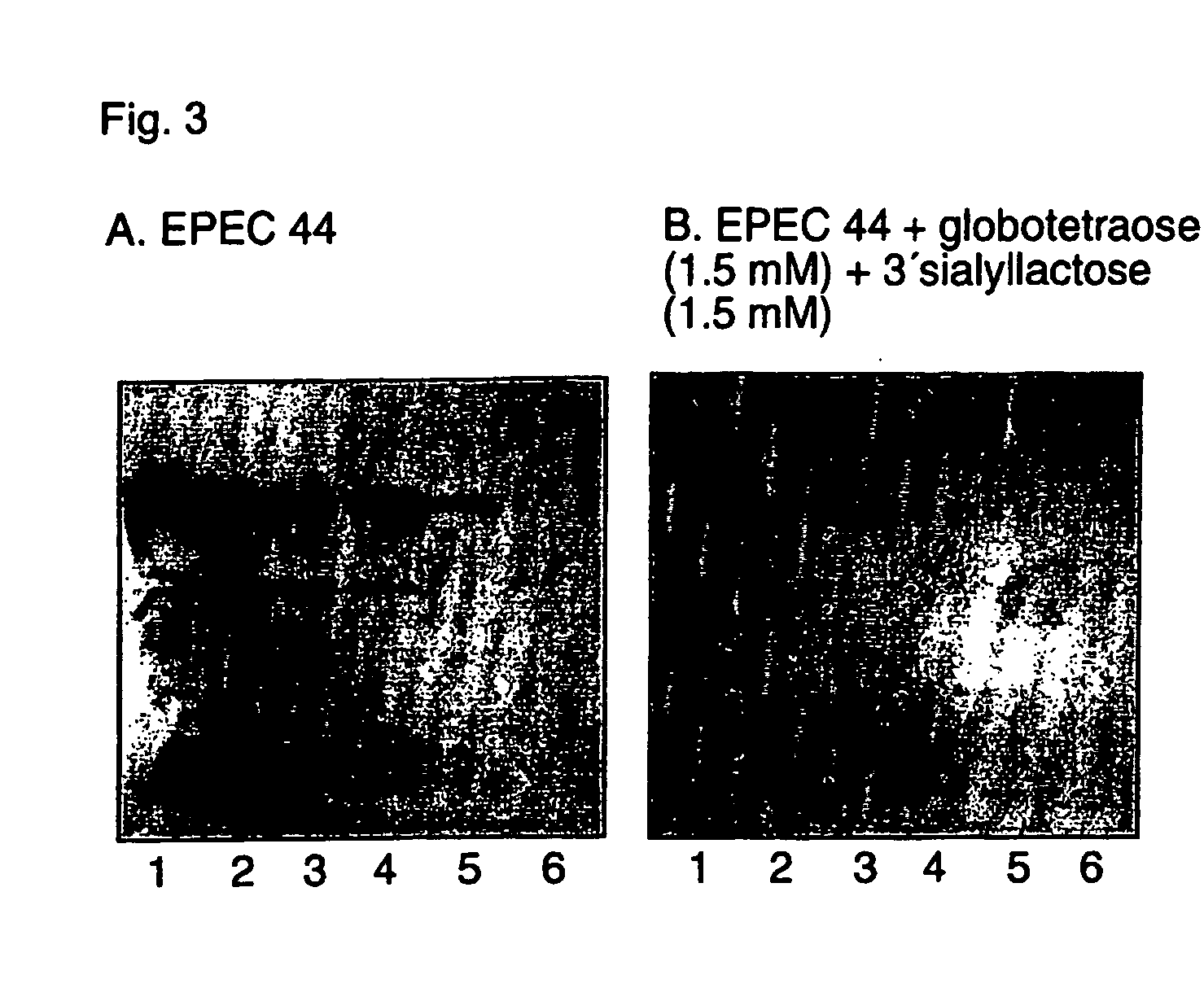 Therapeutic compositions for use in prophylaxis or treatment of diarrheas