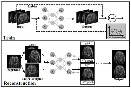 Fast magnetic resonance imaging reconstruction algorithm based on high-dimensional correlation prior information