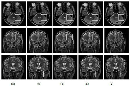 Fast magnetic resonance imaging reconstruction algorithm based on high-dimensional correlation prior information