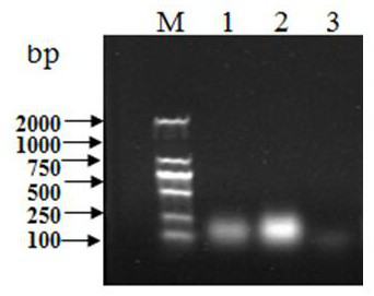 NASBA-ELISA (Nucleic Acid Sequence Based Amplification-Enzyme-Linked Immuno Sorbent Assay) detection primer and probe for detecting porcine epidemic diarrhea