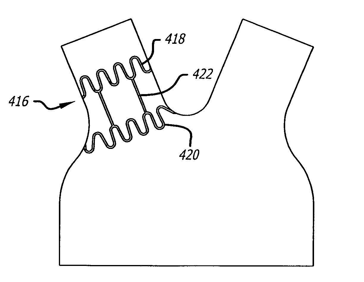 Electrical conduction block implant device
