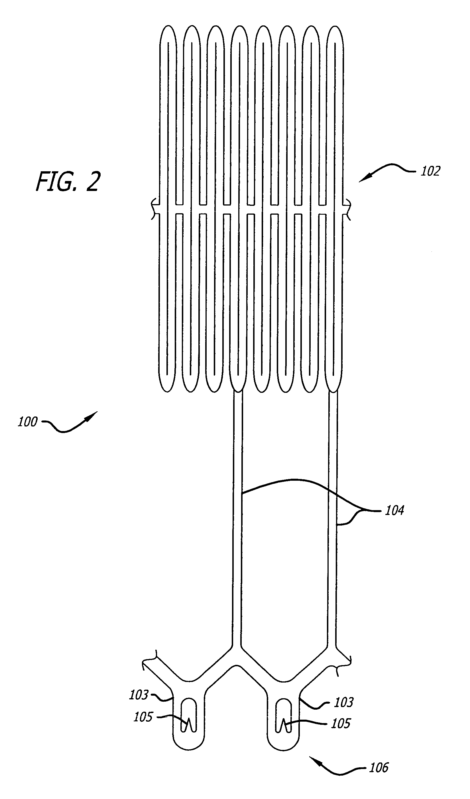 Electrical conduction block implant device