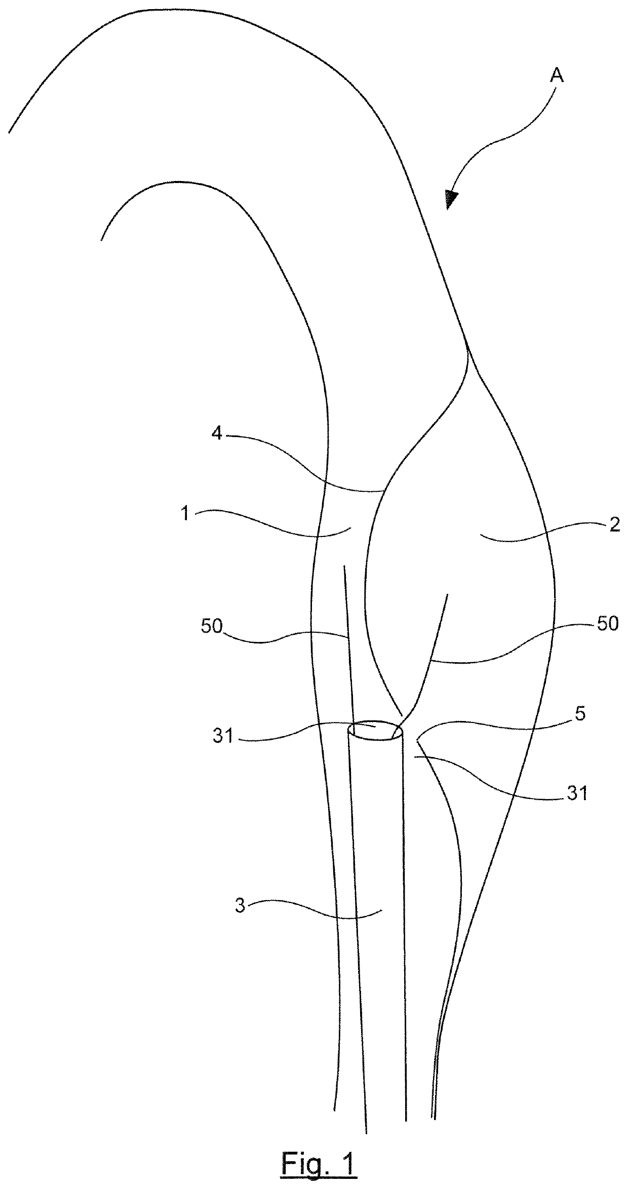 Cutting device for endovascular surgery