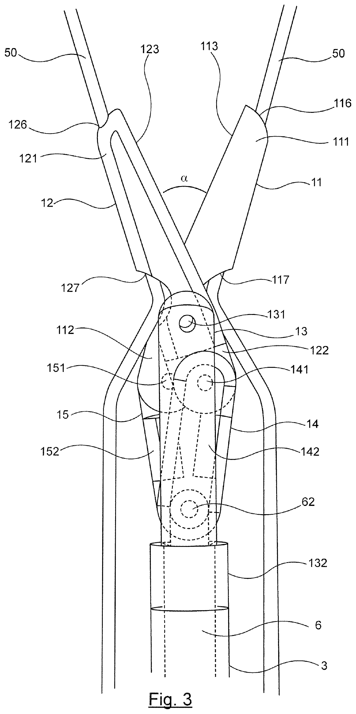 Cutting device for endovascular surgery