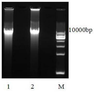 Genetic recombination saccharomyces cerevisiae with detoxification function and construction method and application thereof