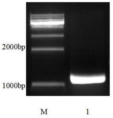 Genetic recombination saccharomyces cerevisiae with detoxification function and construction method and application thereof