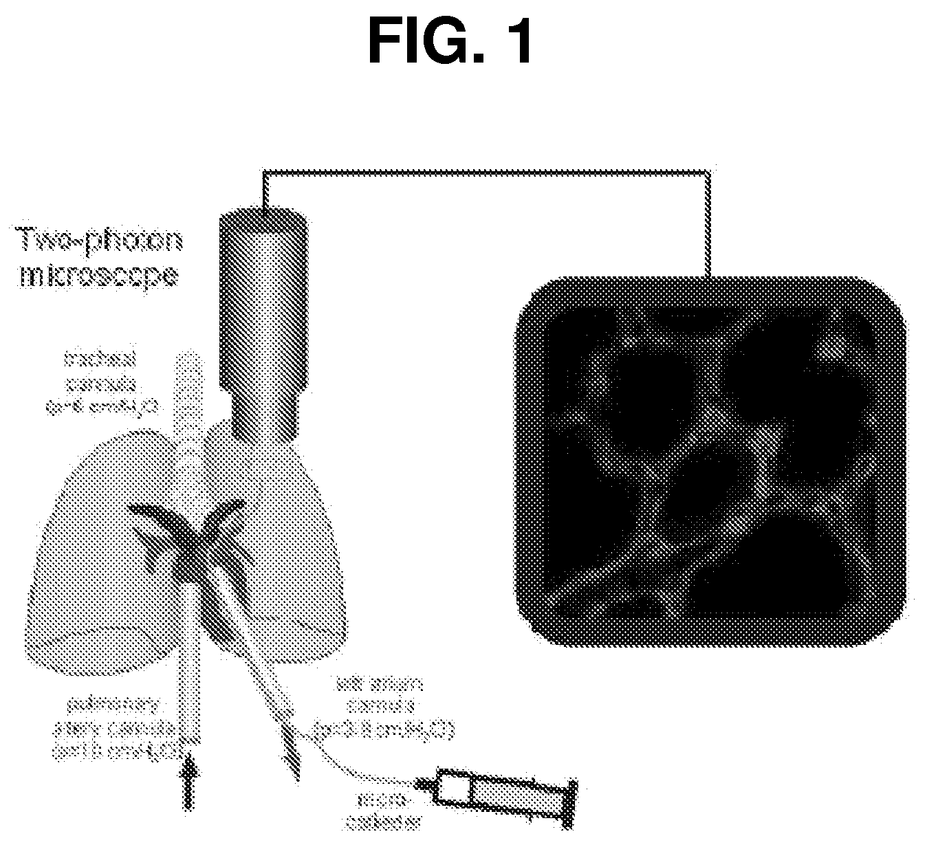 Methods for treating adult respiratory distress syndrome