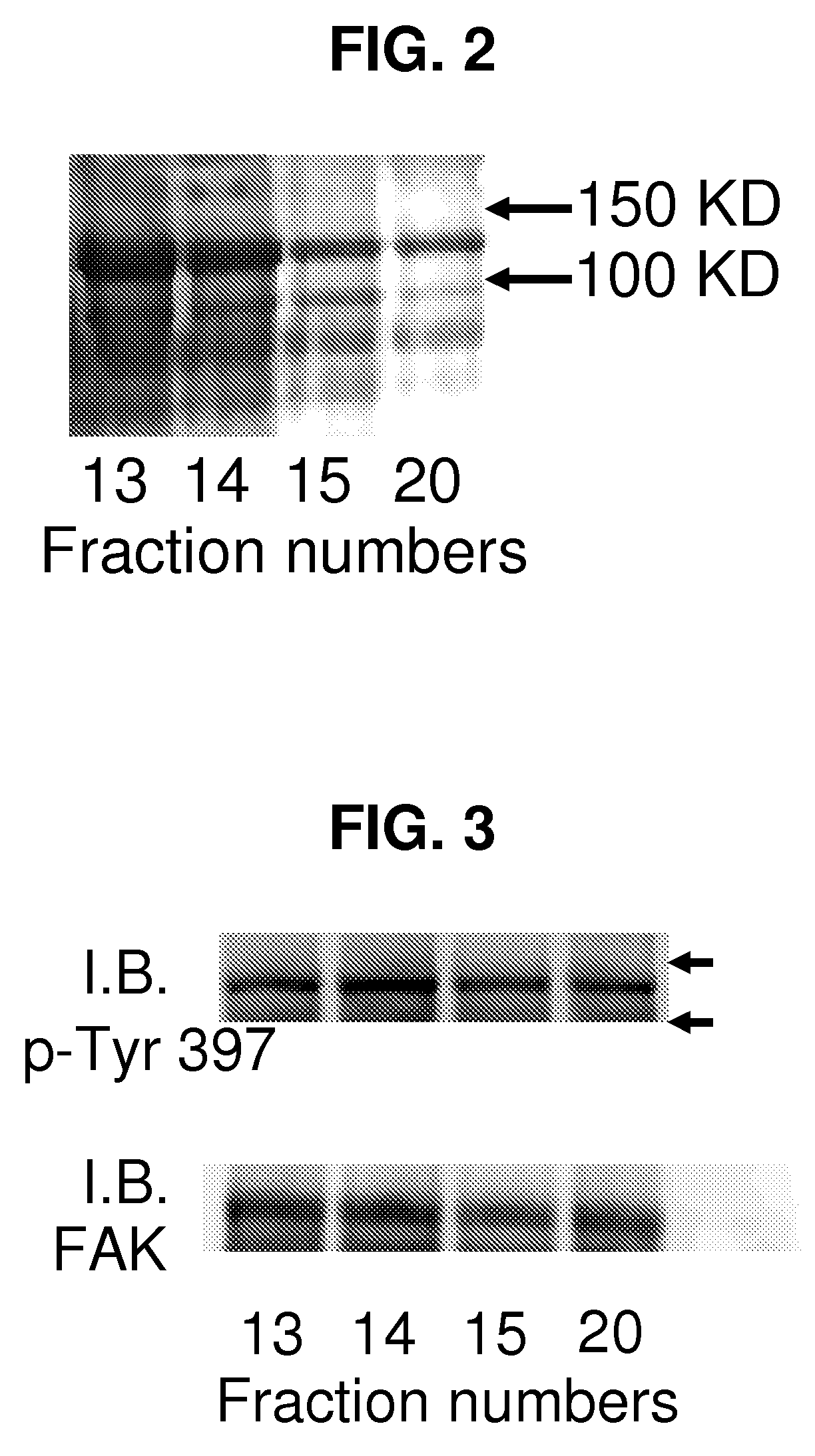 Methods for treating adult respiratory distress syndrome