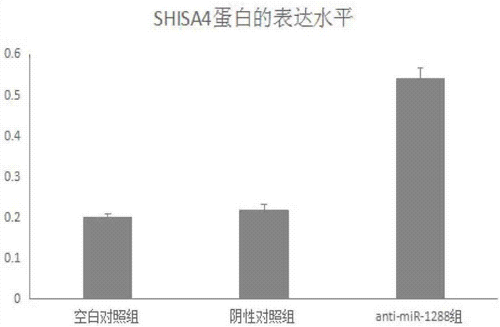 Application of miR-1288 to diagnosis or treatment of osteoarthritis disease