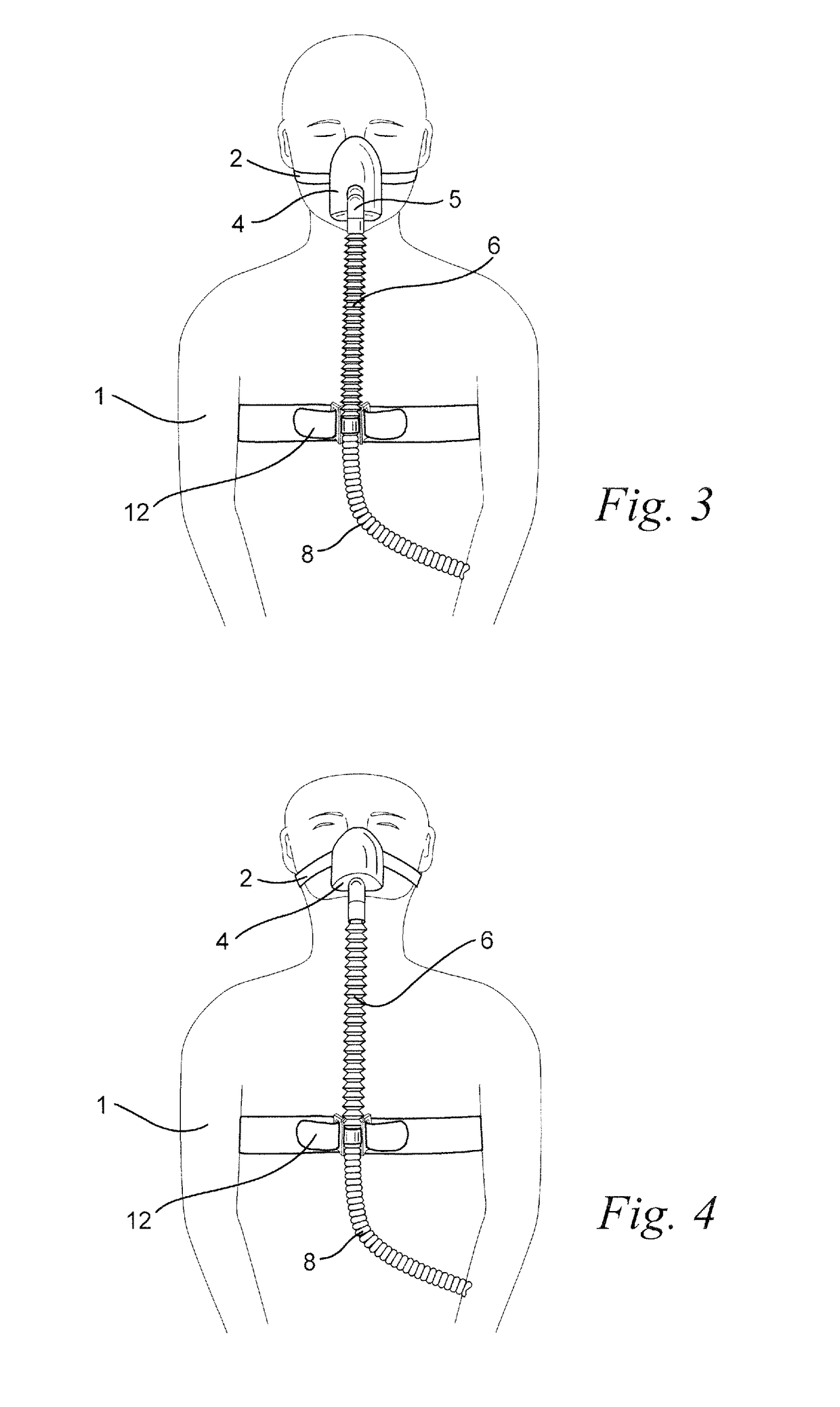 Retractable tube for CPAP