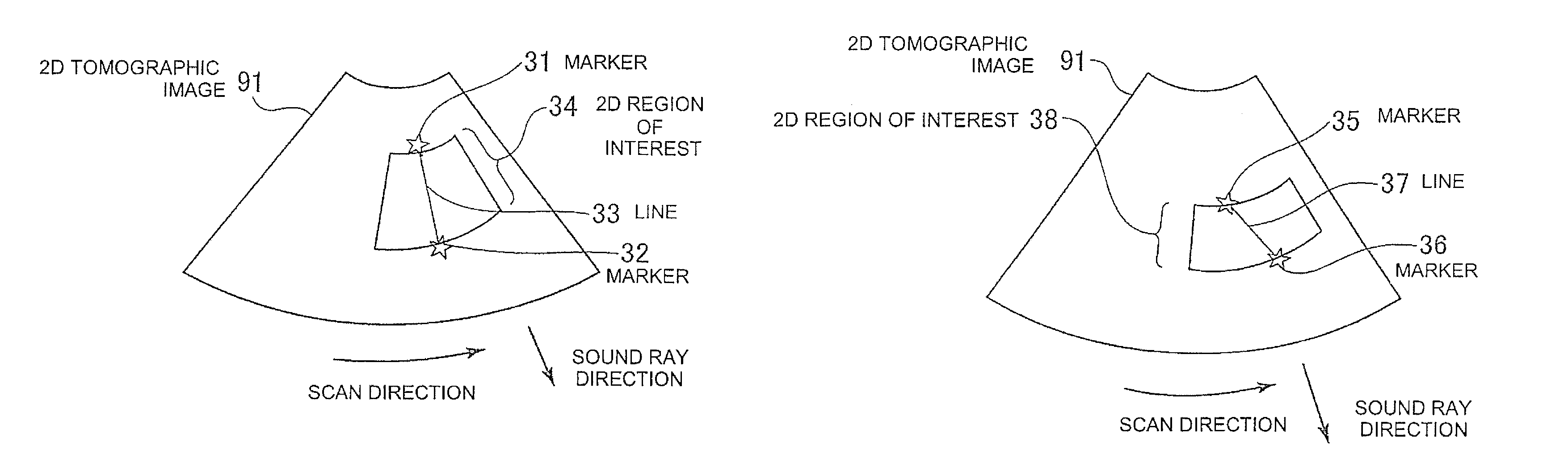 Ultrasonic imaging apparatus and image processing apparatus