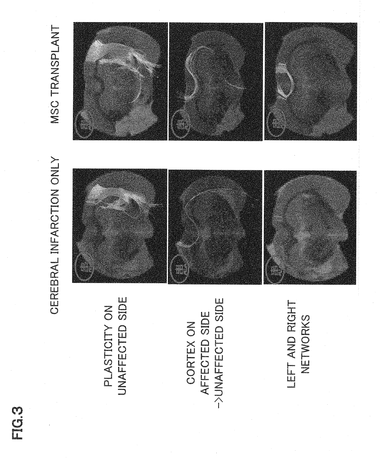 Synapse formation agent