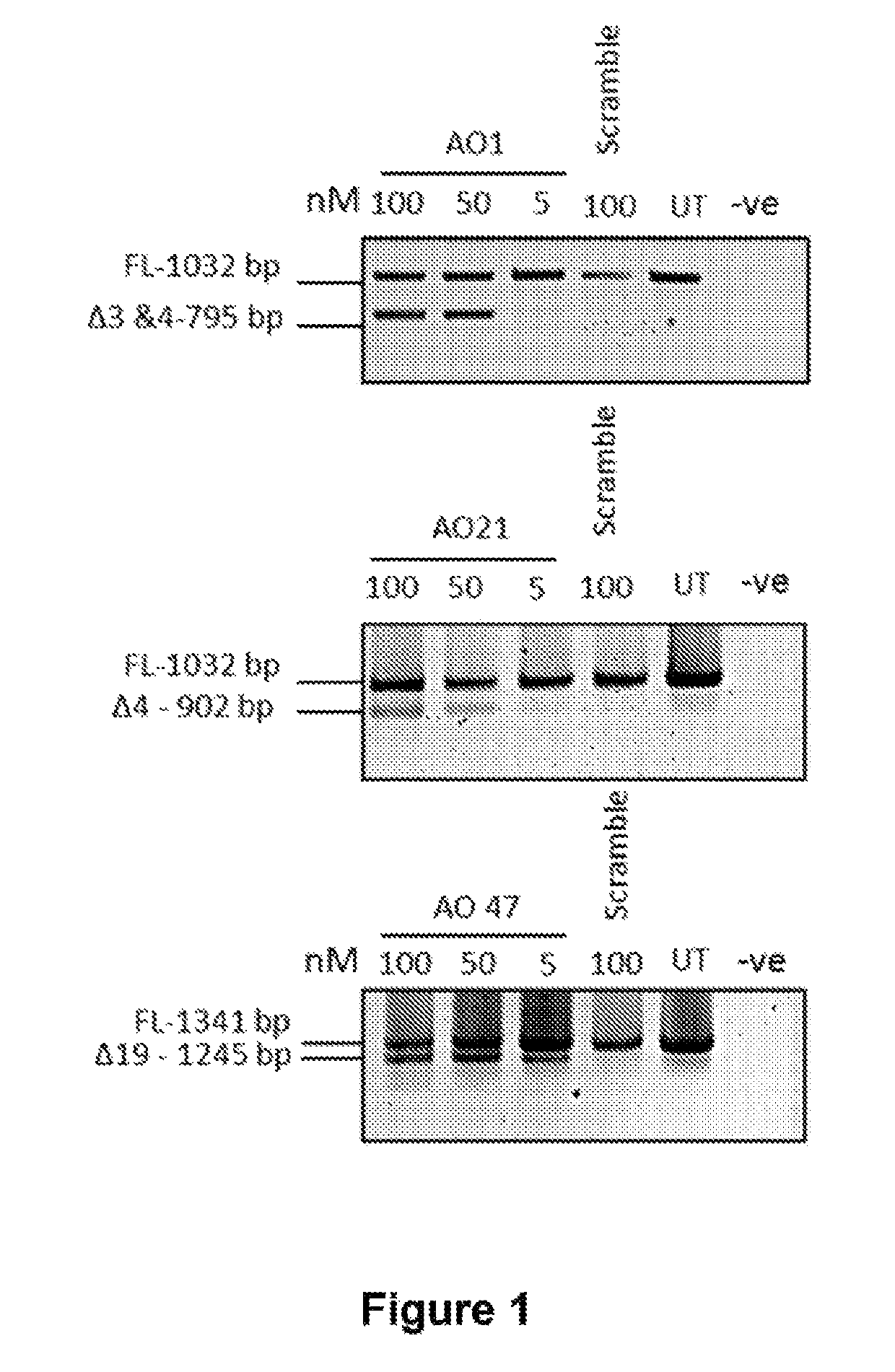 Multiple sclerosis treatment