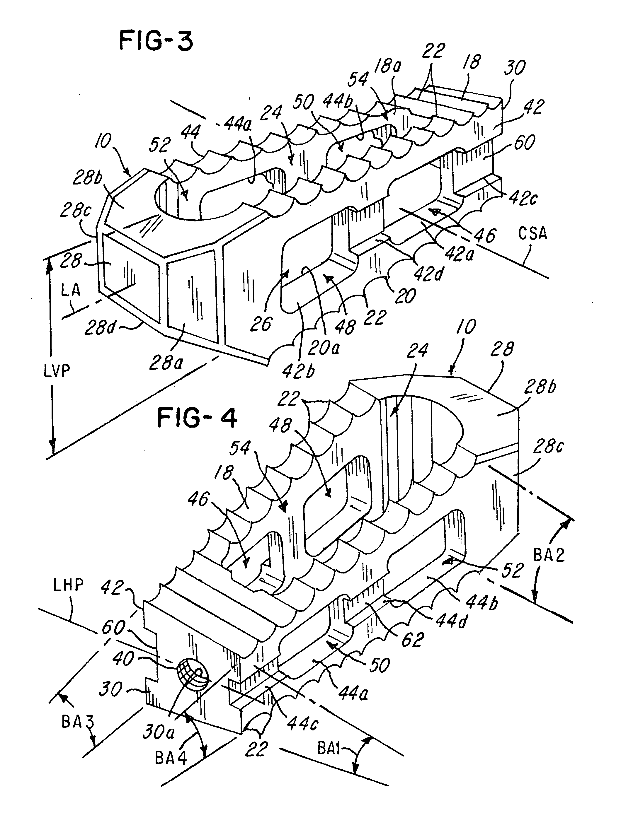 Prosthetic implant with biplanar angulation and compound angles