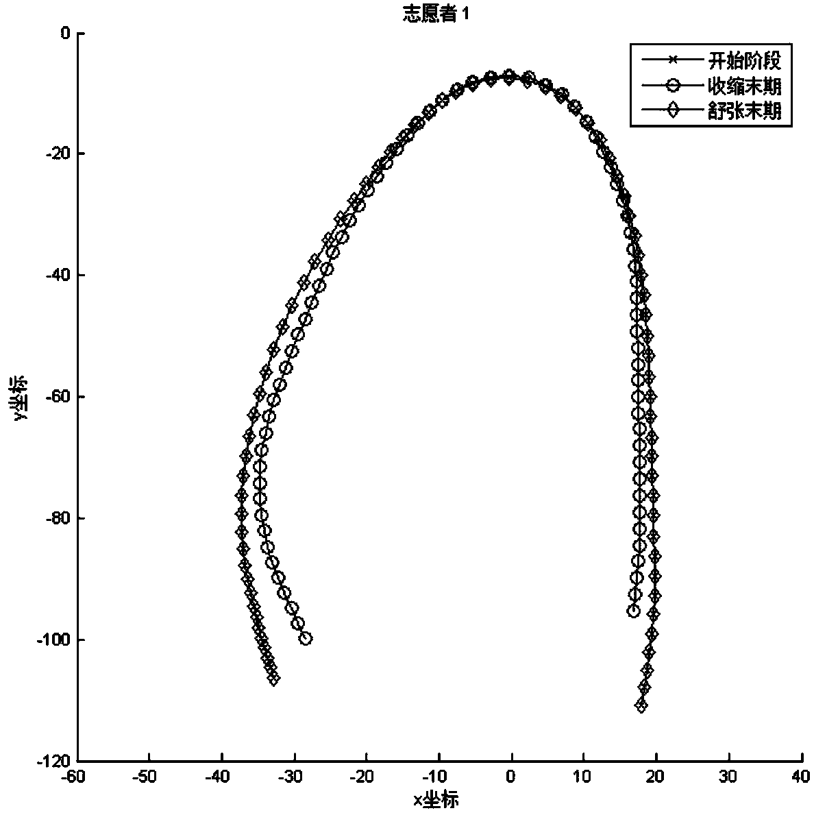 Analysis method of myocardial shapes, motions and deformations in two-dimensional echocardiogram sequence