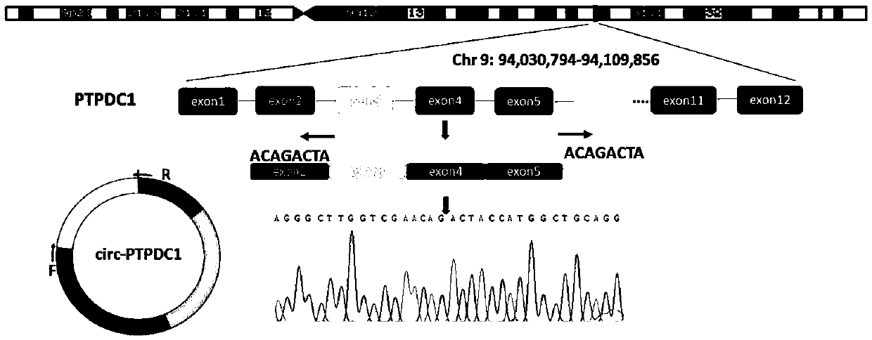 Application of novel gastric cancer marker gene circPTPDC1