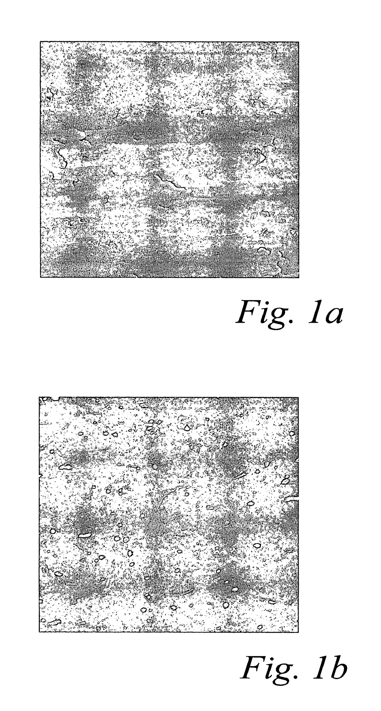 Surface treatment process for implants made of titanium alloy