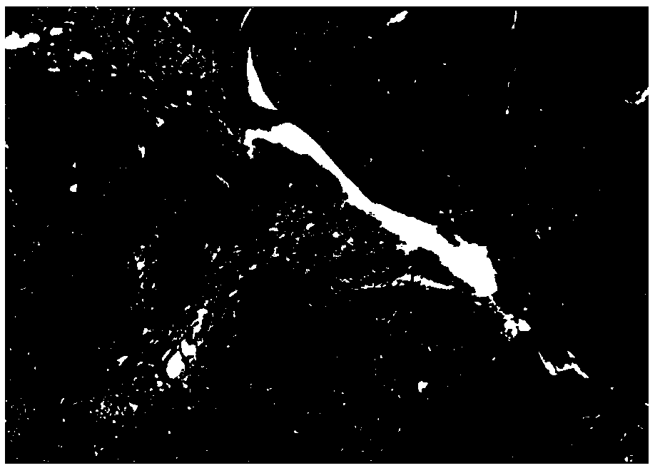 Automatic analysis method of ki67 index