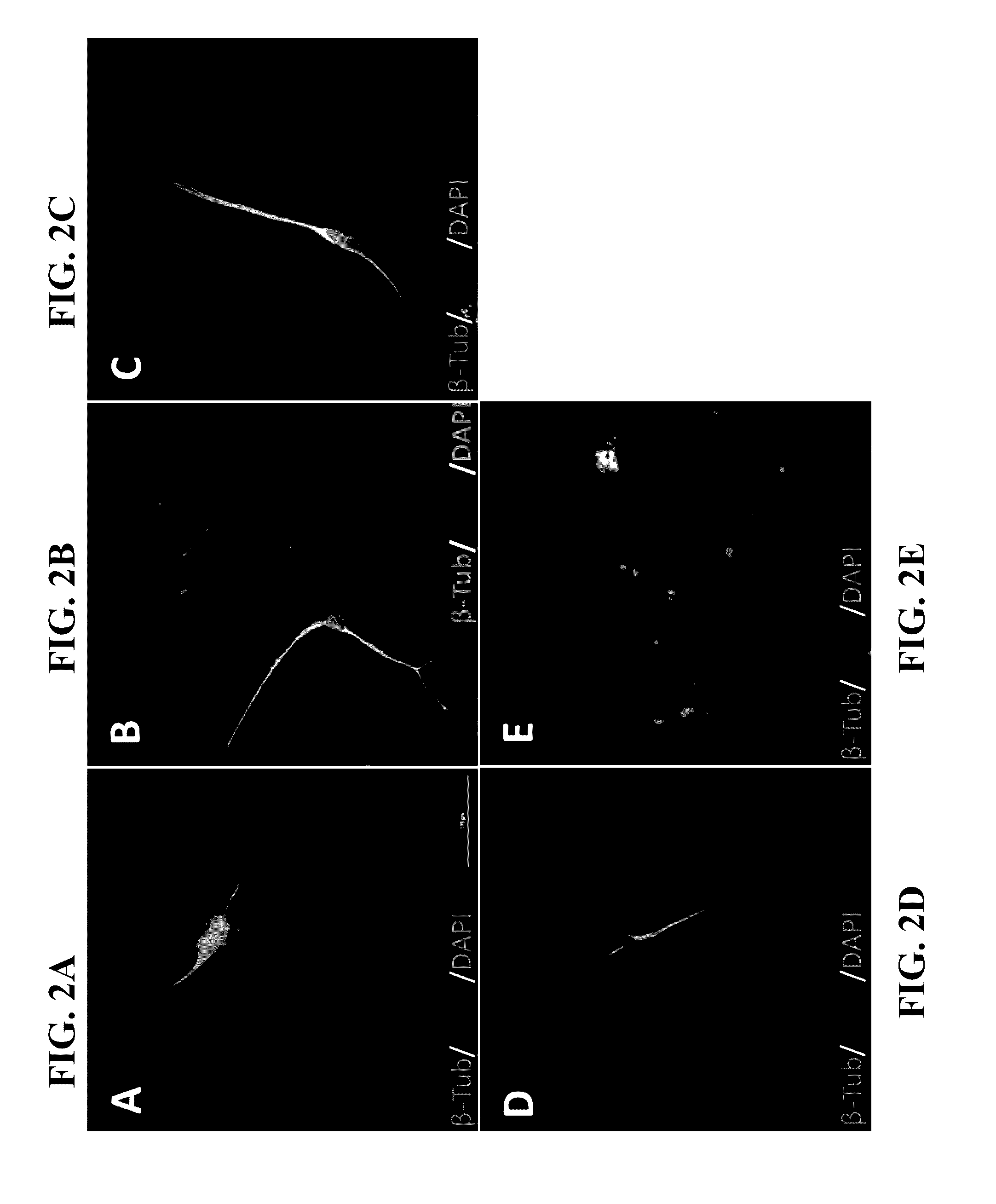 Conversion of non-neuronal cells into neurons