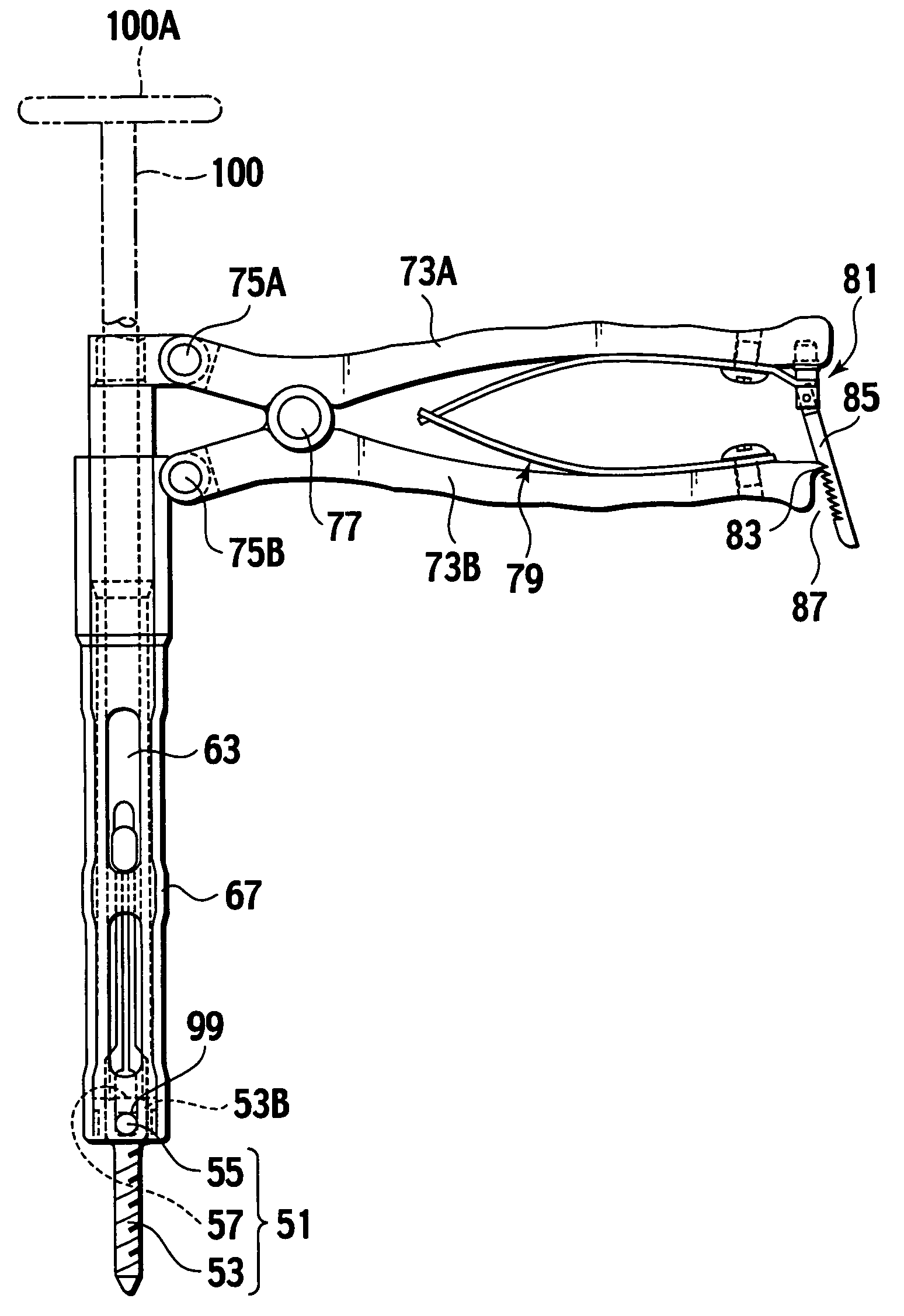 Auxiliary instrument for fixing rod