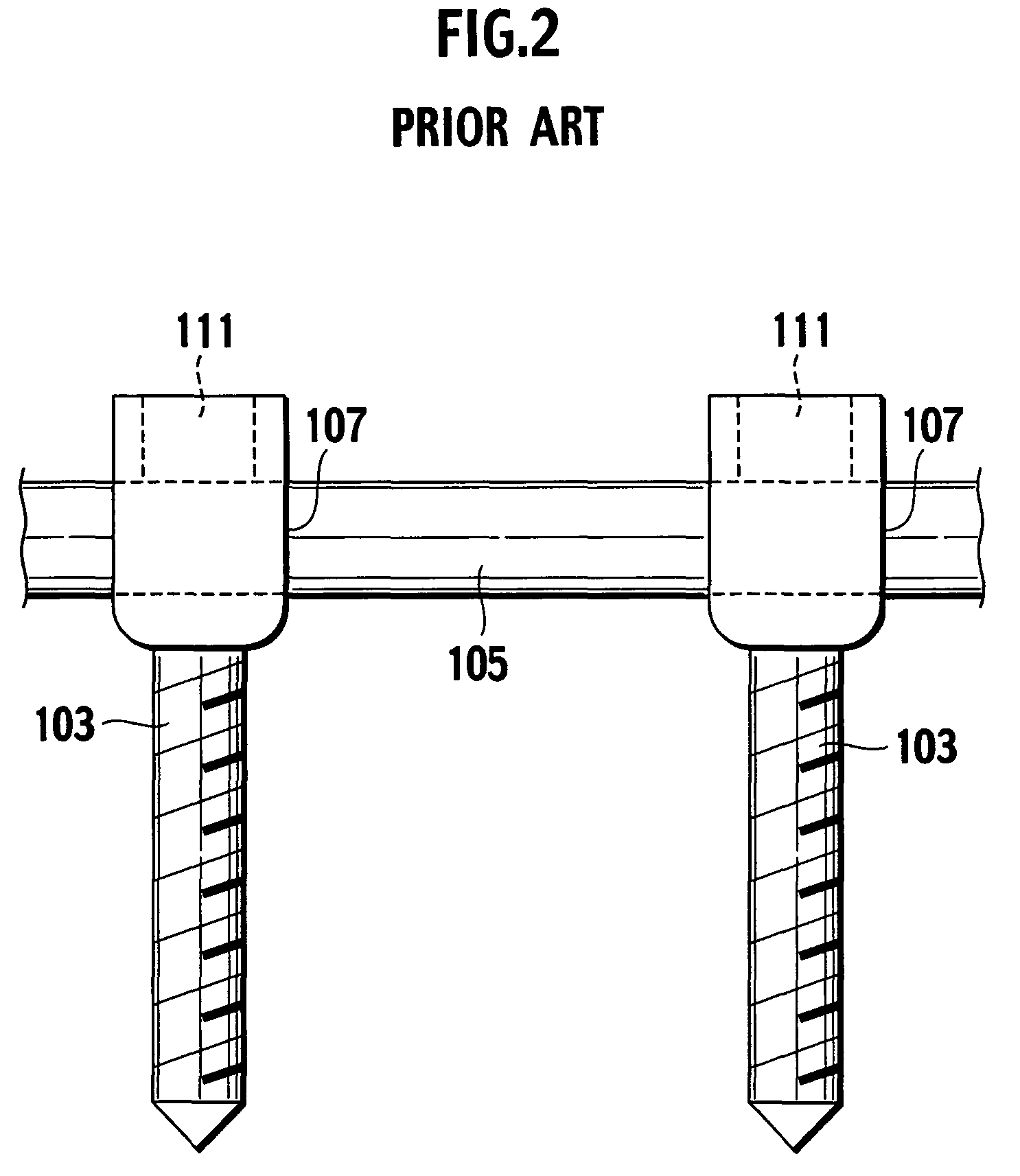 Auxiliary instrument for fixing rod