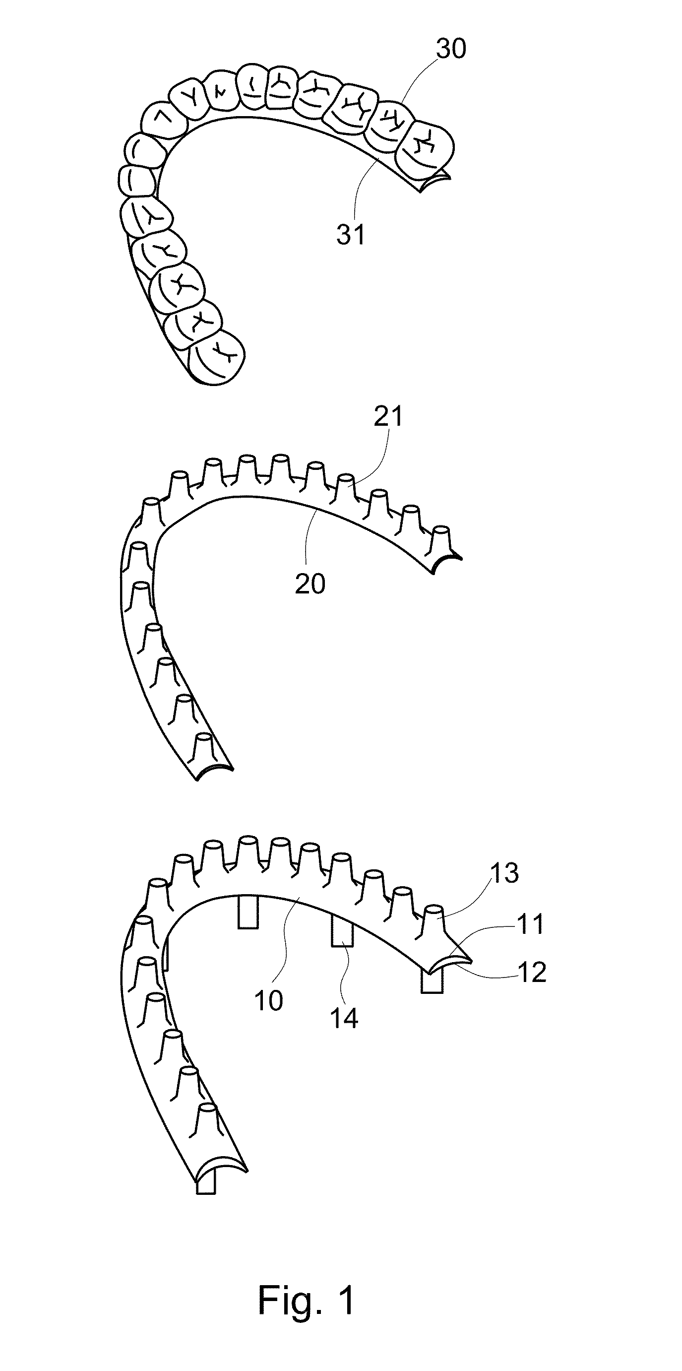 Artificial teethridge and fang