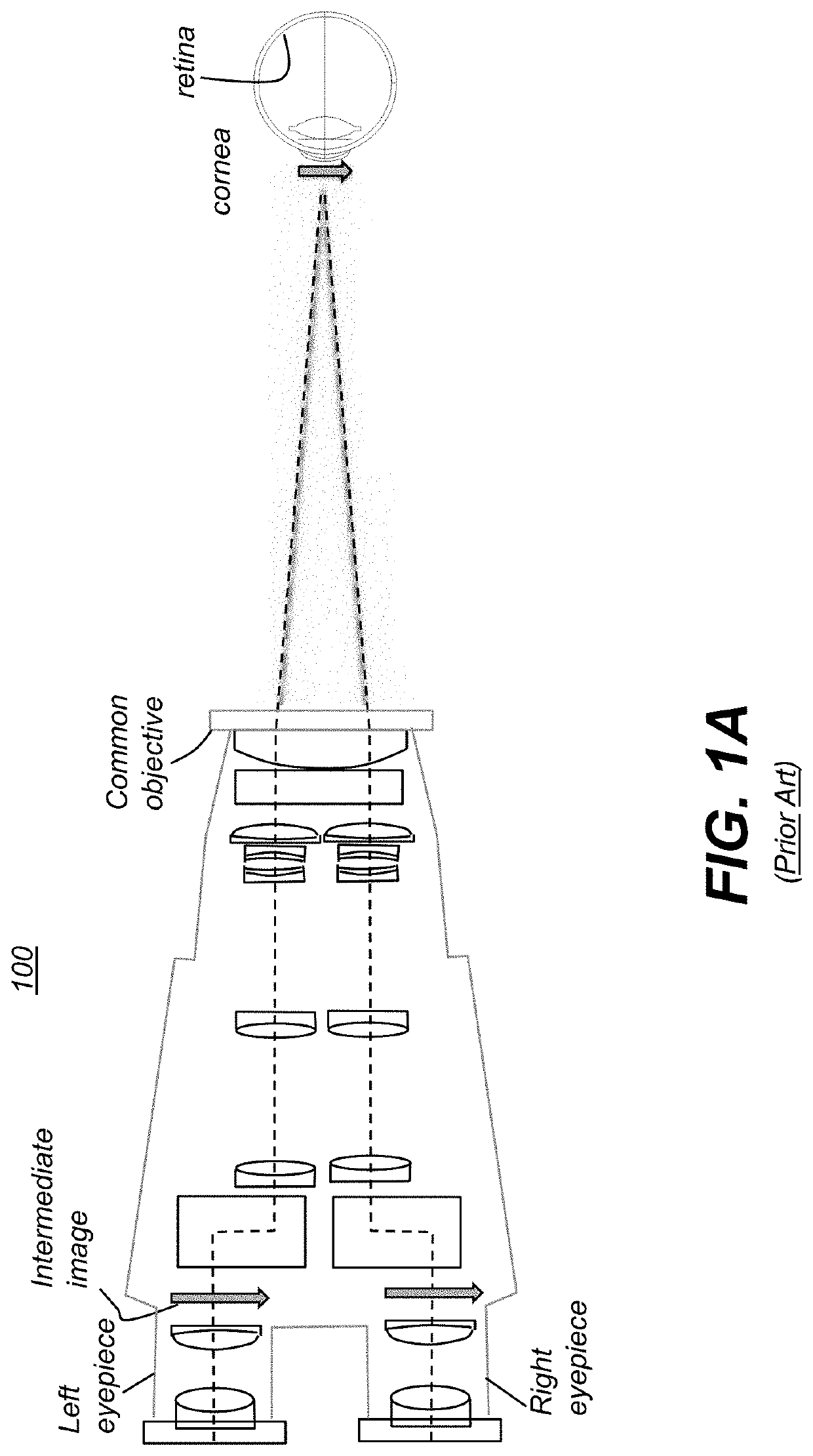 Surgery 3D visualization apparatus