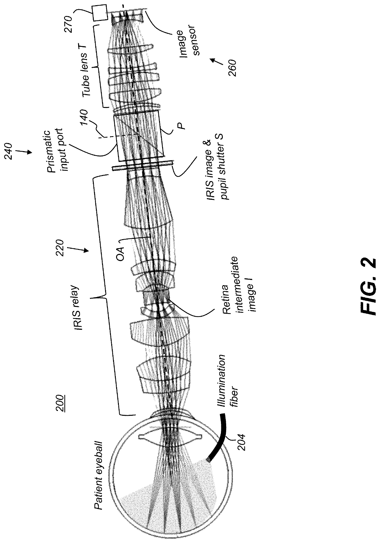 Surgery 3D visualization apparatus