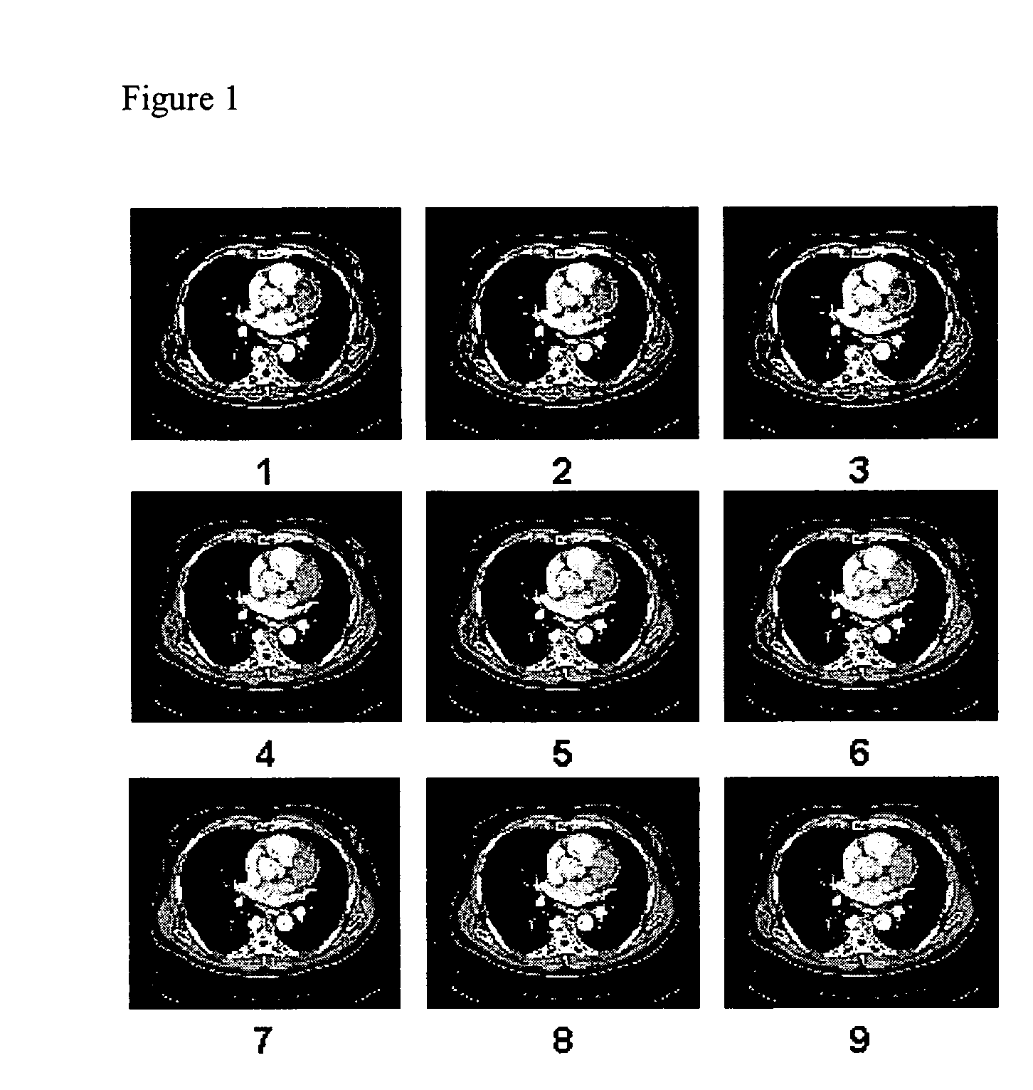 System and method for displaying images on a pacs workstation based on level of significance