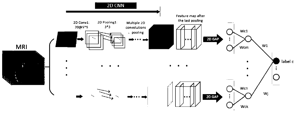 Brain nuclear magnetic resonance abnormal image visualization method based on 2D CAM