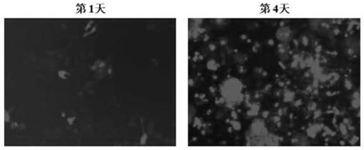 A polymer self-healing gel integrating magnetic resonance imaging and photothermal therapy and its preparation and application