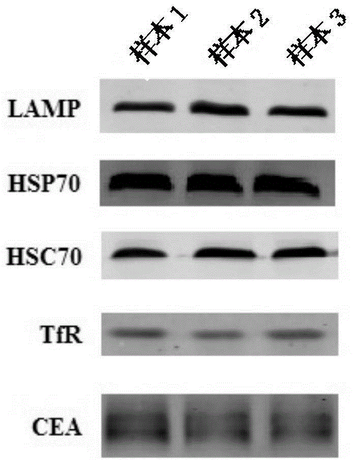 High-quality exosome and preparation method thereof
