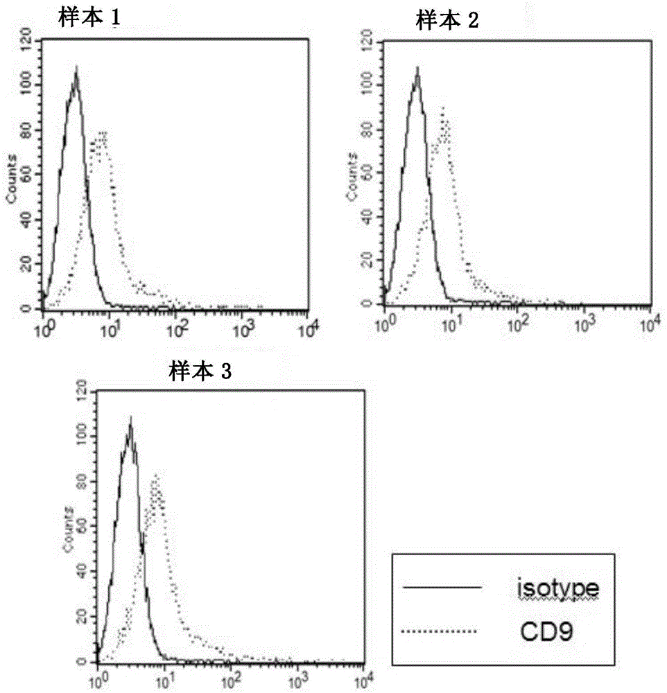 High-quality exosome and preparation method thereof