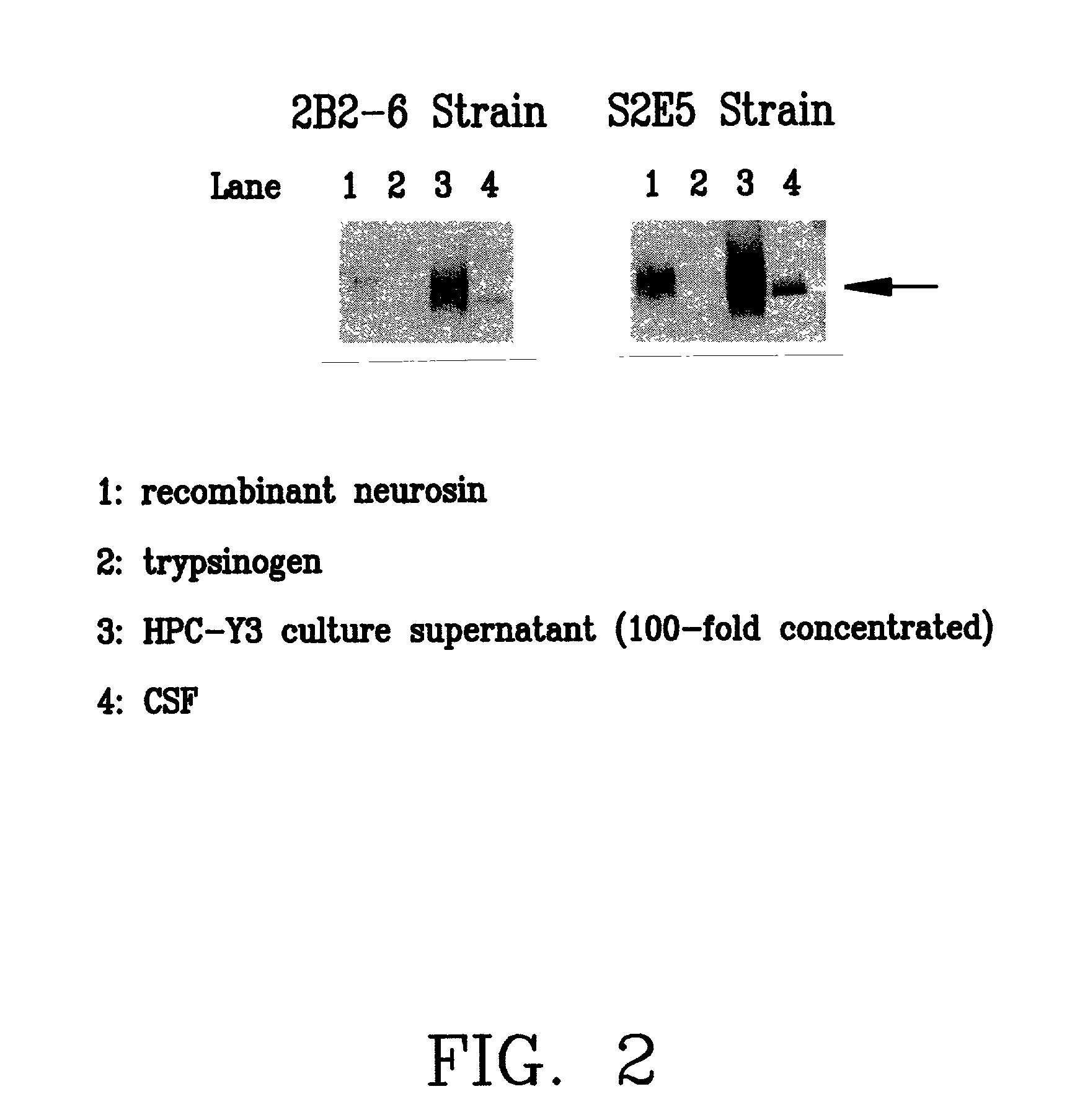 Serine protease specific monoclonal antibodies and their use