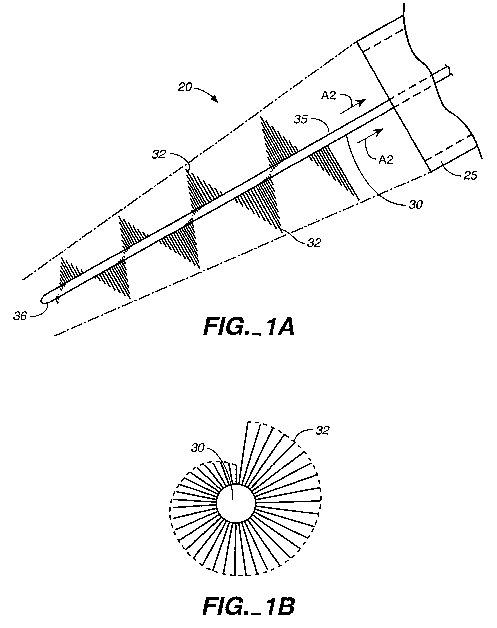Intravascular material removal device