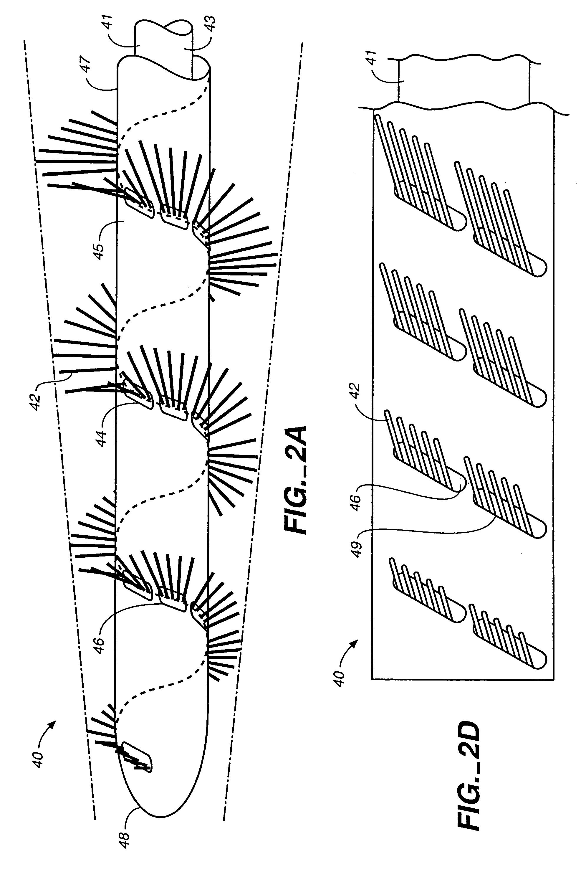 Intravascular material removal device
