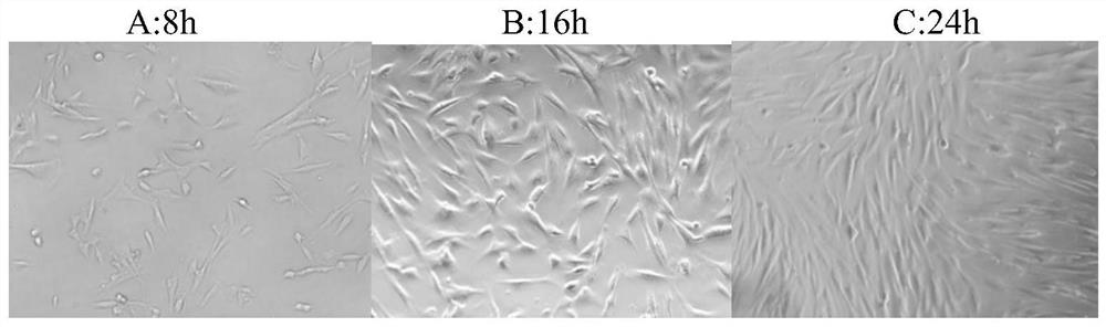 Preparation method and application of spider thread drug-loaded oral sustained-release membrane