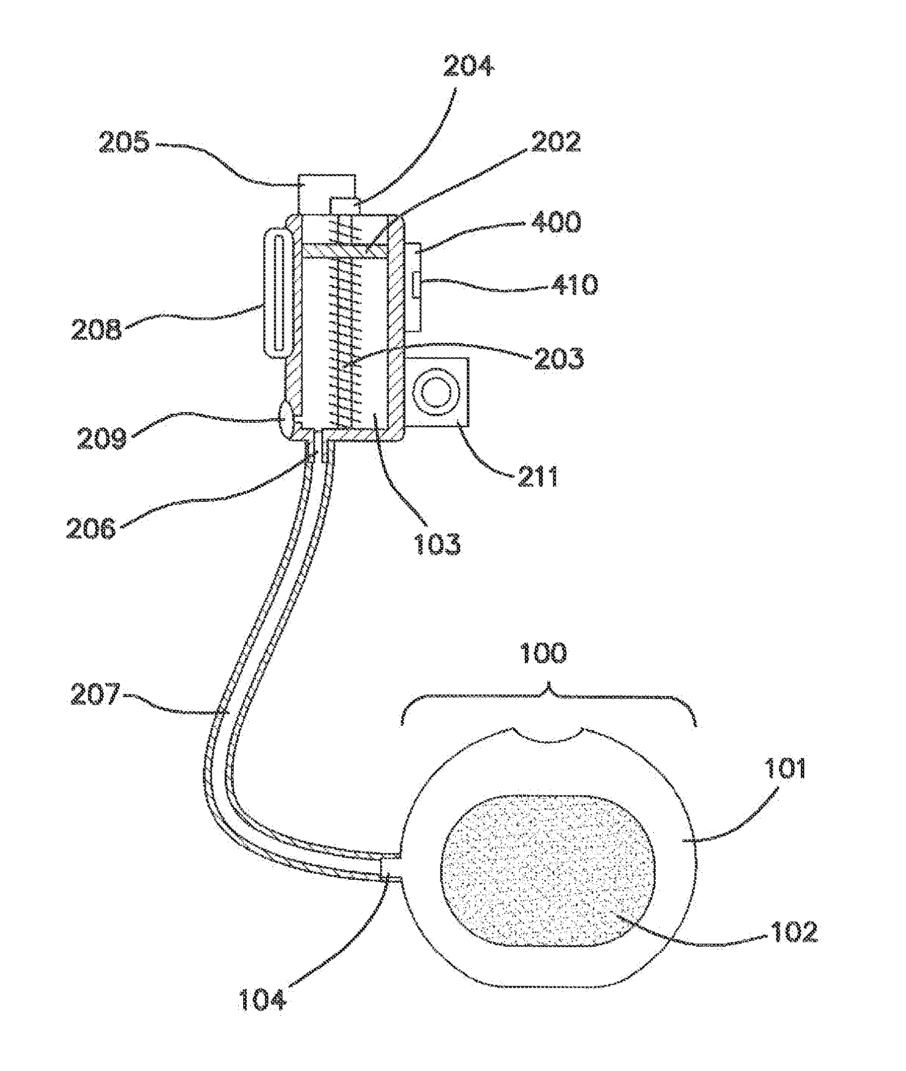 Remotely Activated Piezoelectric Pump for Delivery of Biological Agents to the Intervertebral Disc and Spine