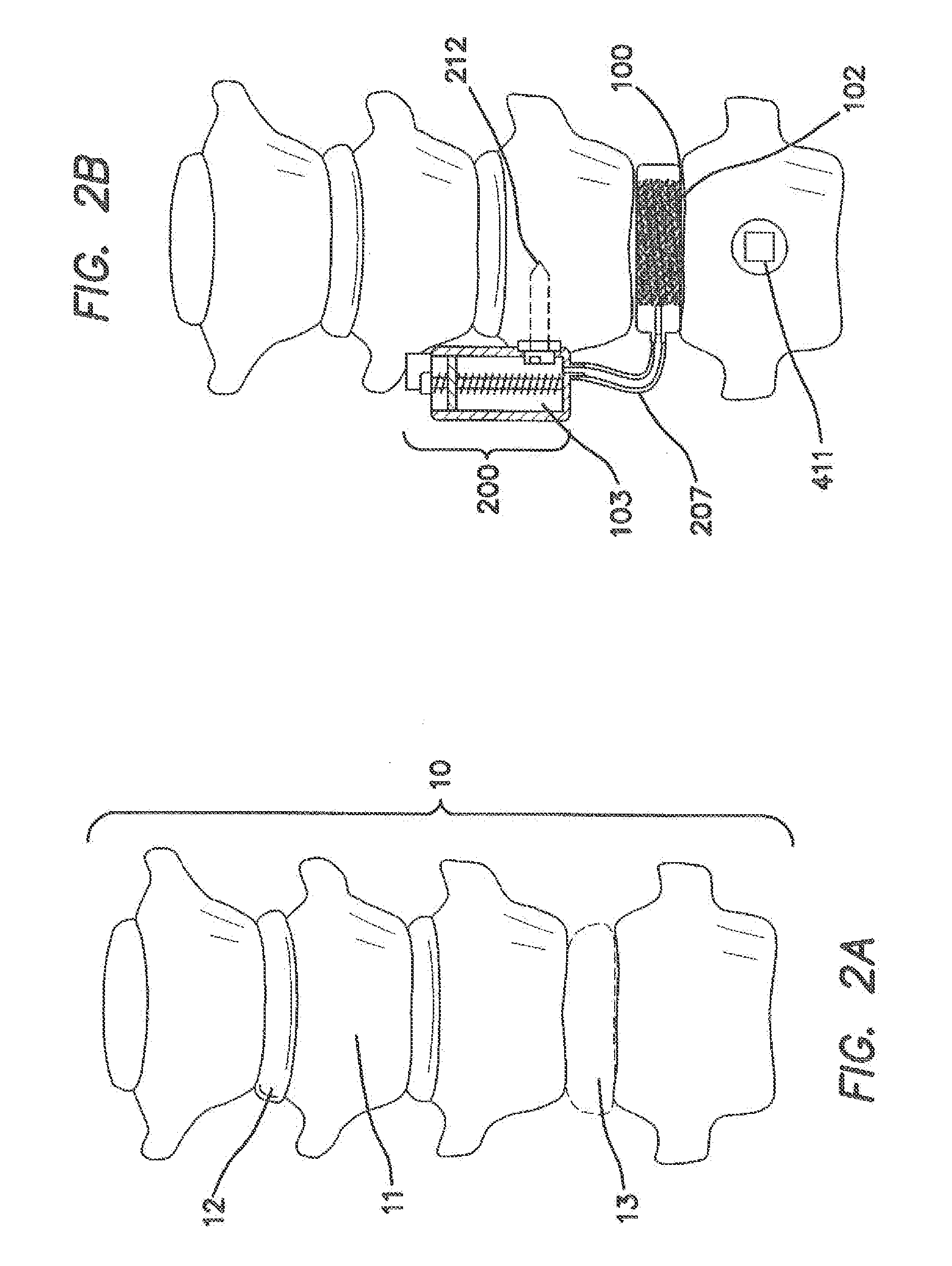 Remotely Activated Piezoelectric Pump for Delivery of Biological Agents to the Intervertebral Disc and Spine