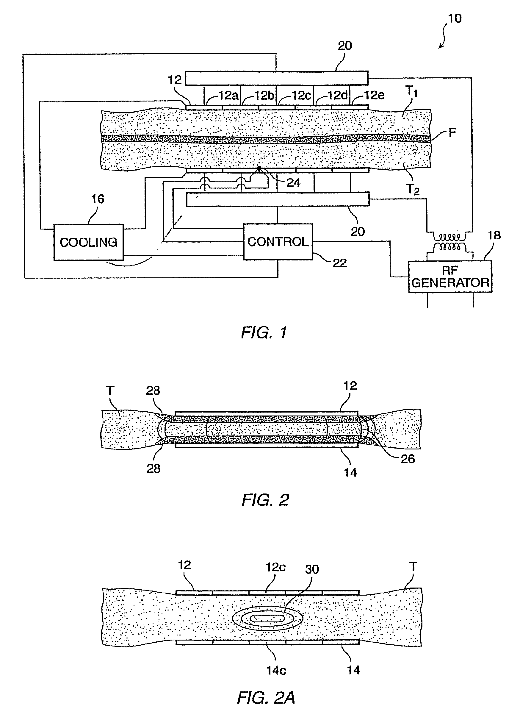 Noninvasive devices, methods, and systems for shrinking of tissues