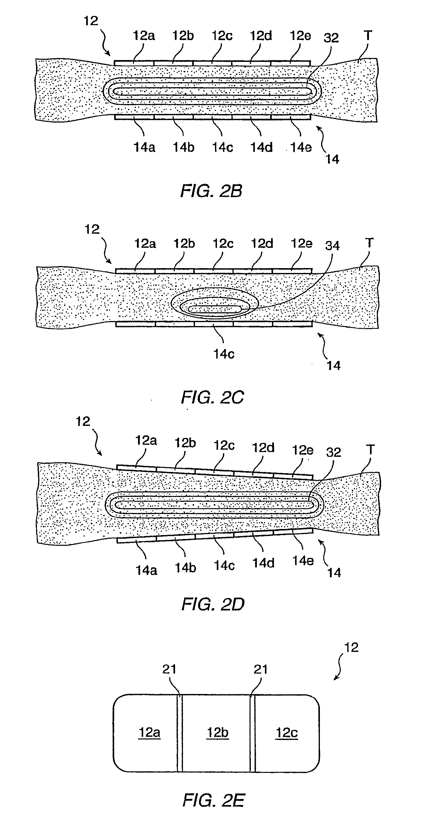 Noninvasive devices, methods, and systems for shrinking of tissues