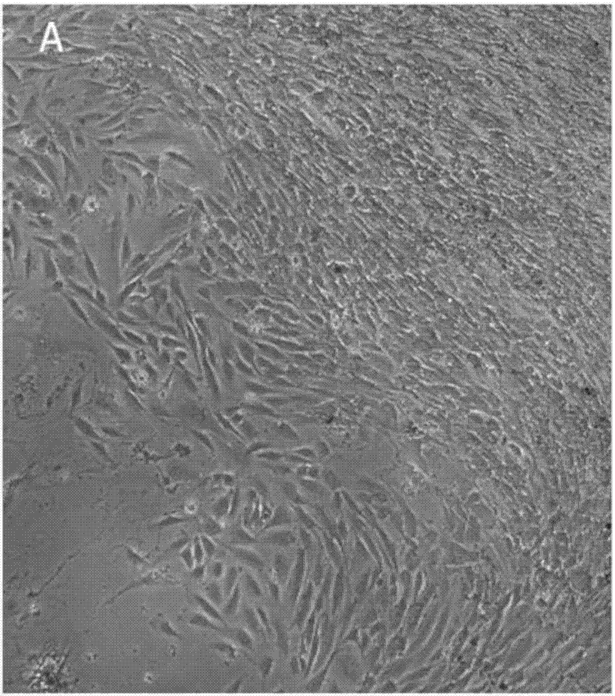 Human anaplastic thyroid carcinoma cell line and application thereof