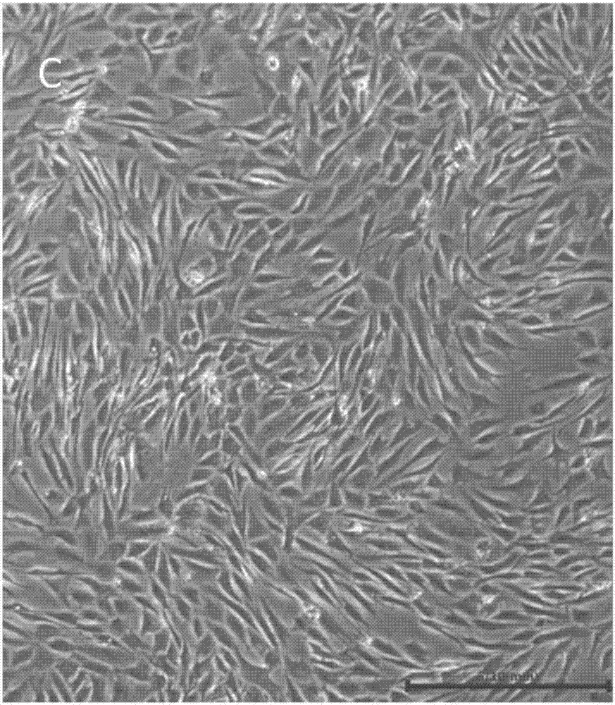 Human anaplastic thyroid carcinoma cell line and application thereof