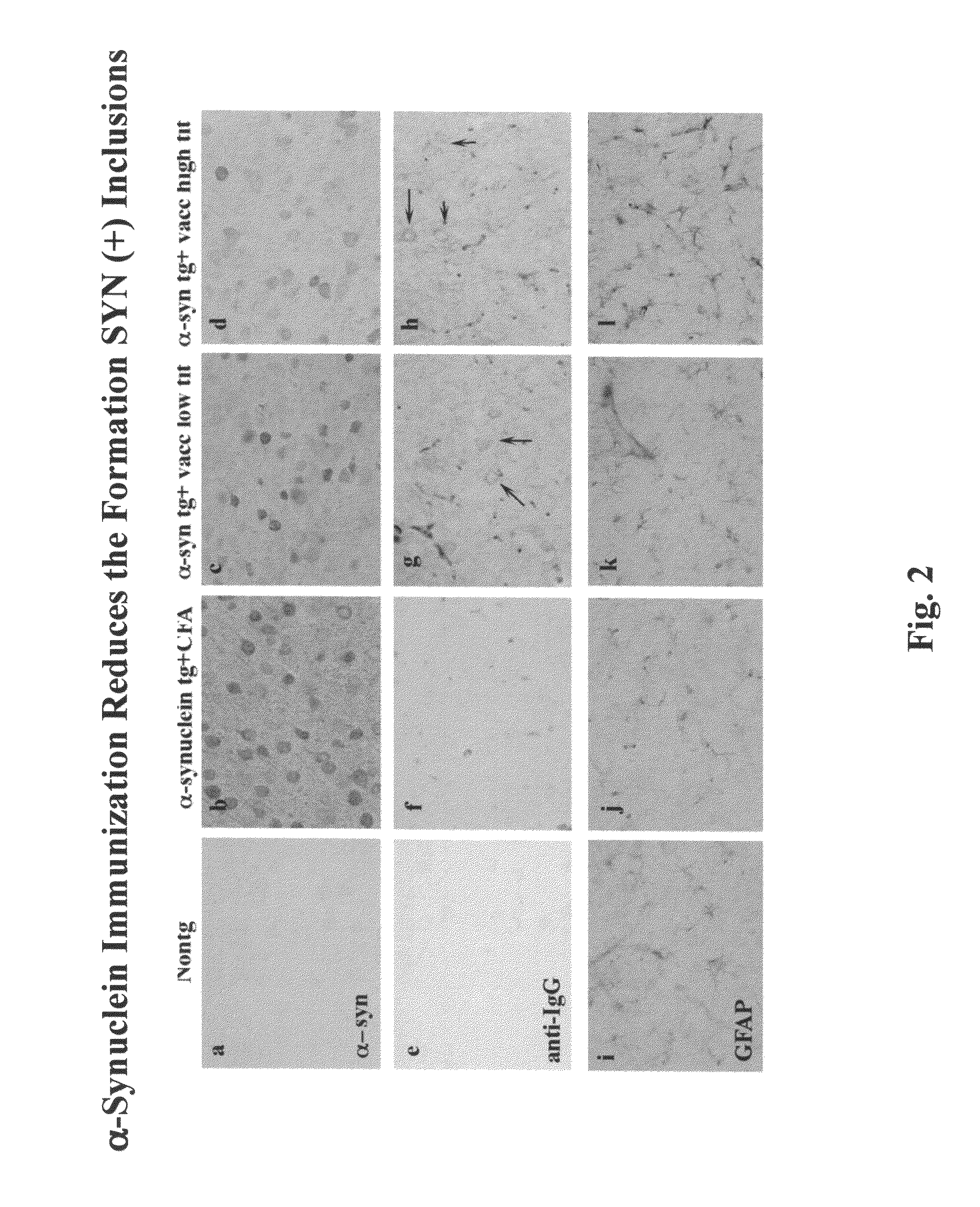 Prevention and treatment of synucleinopathic and amyloidogenic disease