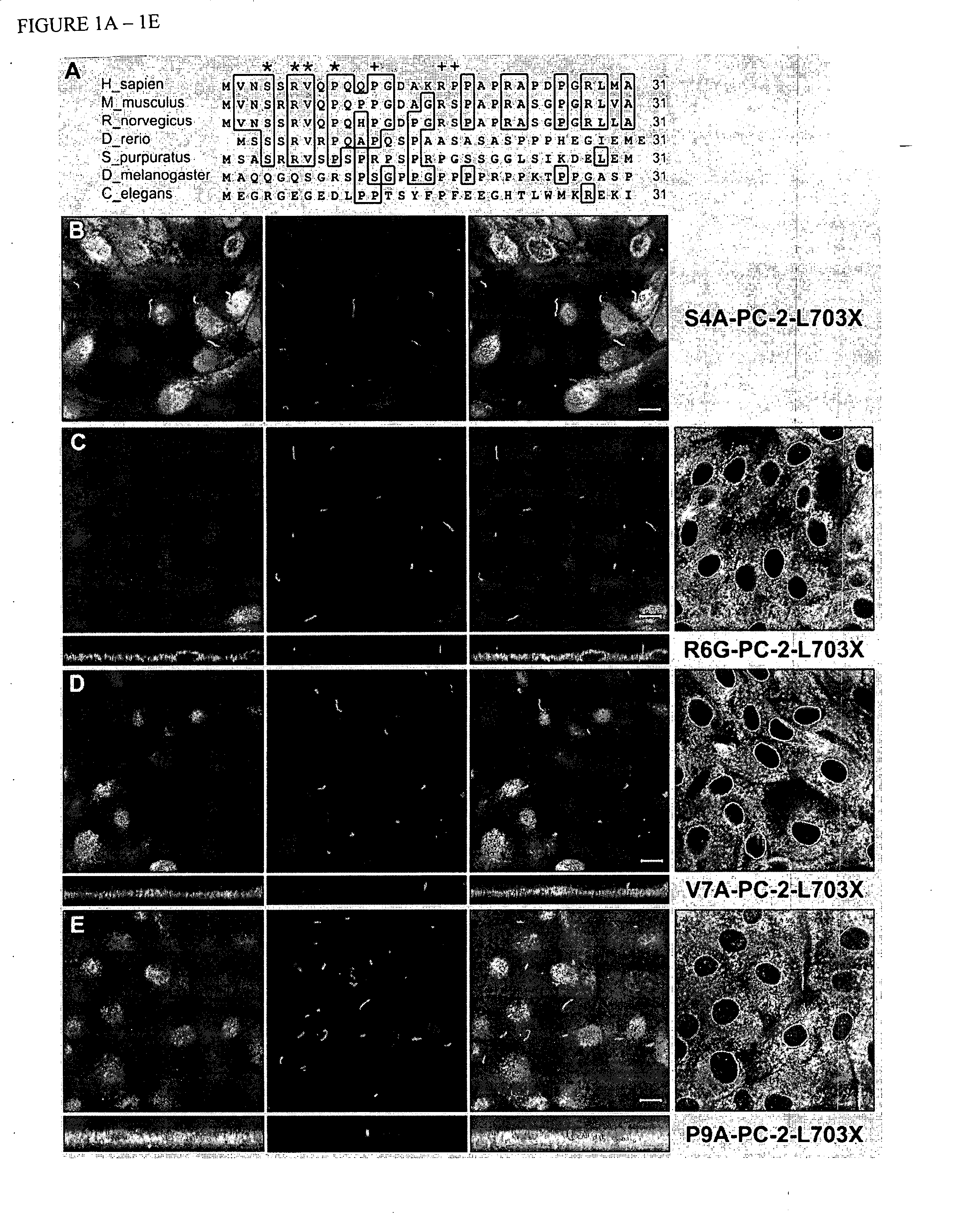 Compositions and methods relating to polycystic kidney disease