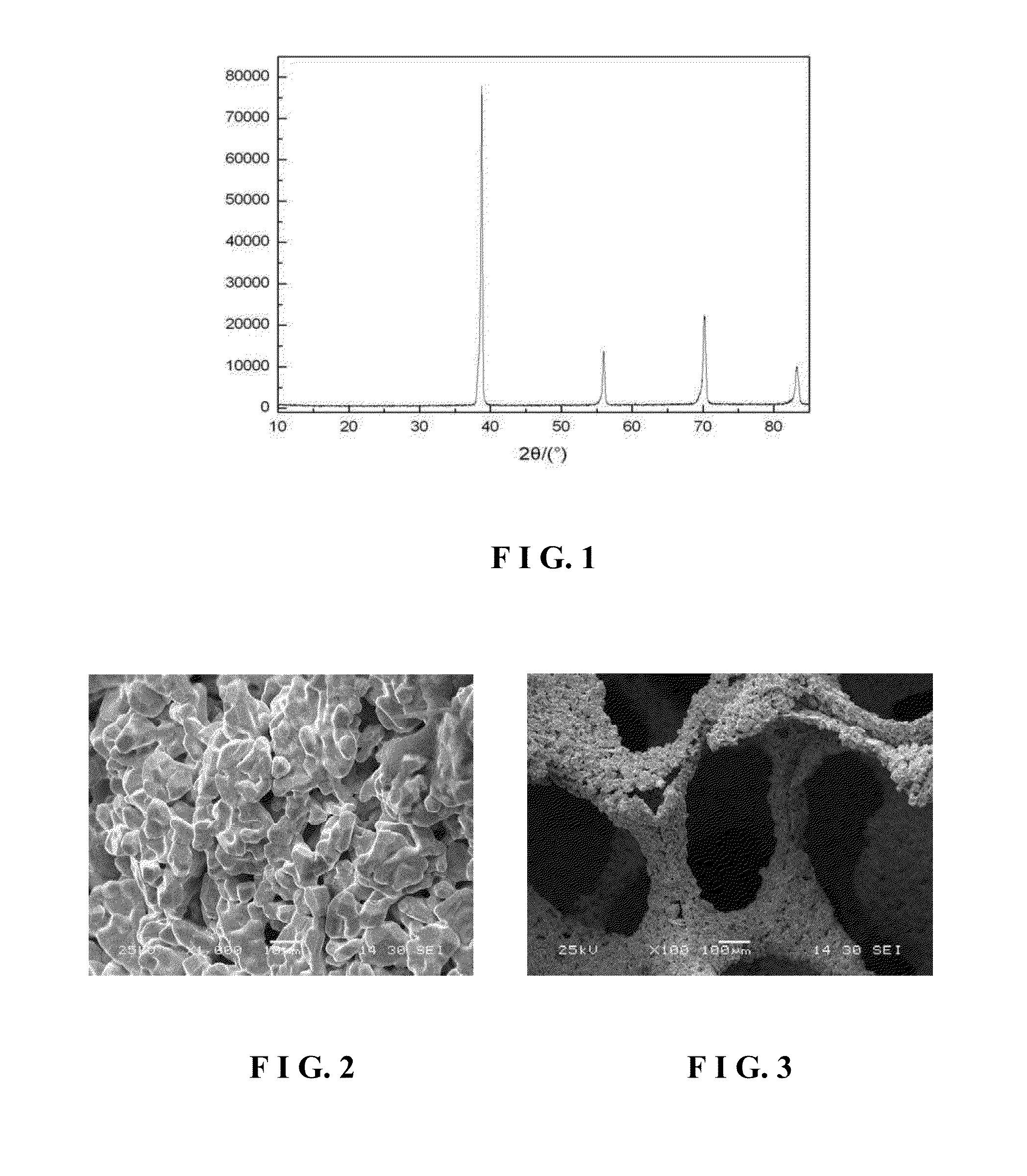 Porous tantalum used for medical implantation and method for preparing the same
