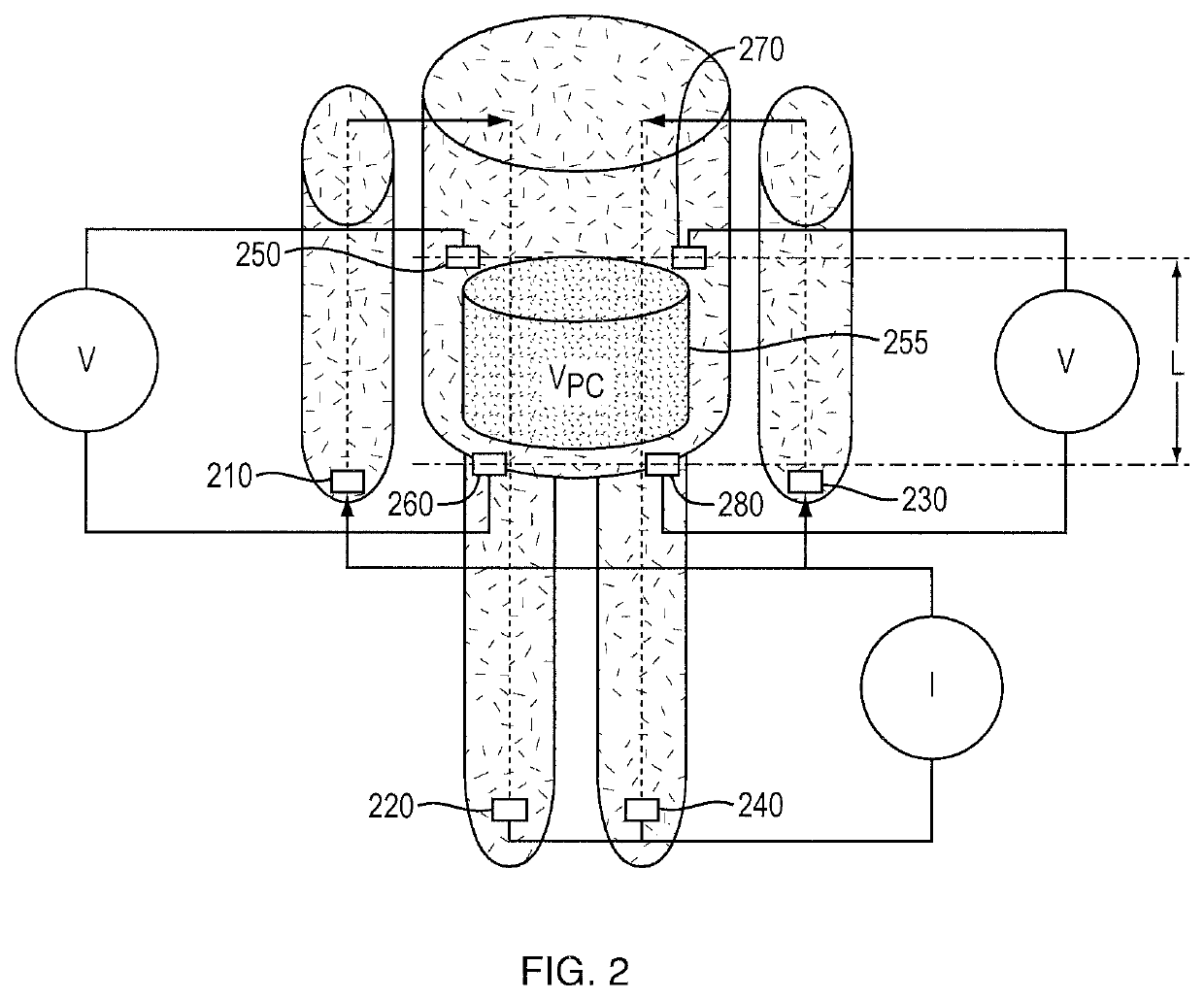 System and method of monitoring and control of ultrafiltration volume during peritoneal dialysis using segmental bioimpedance