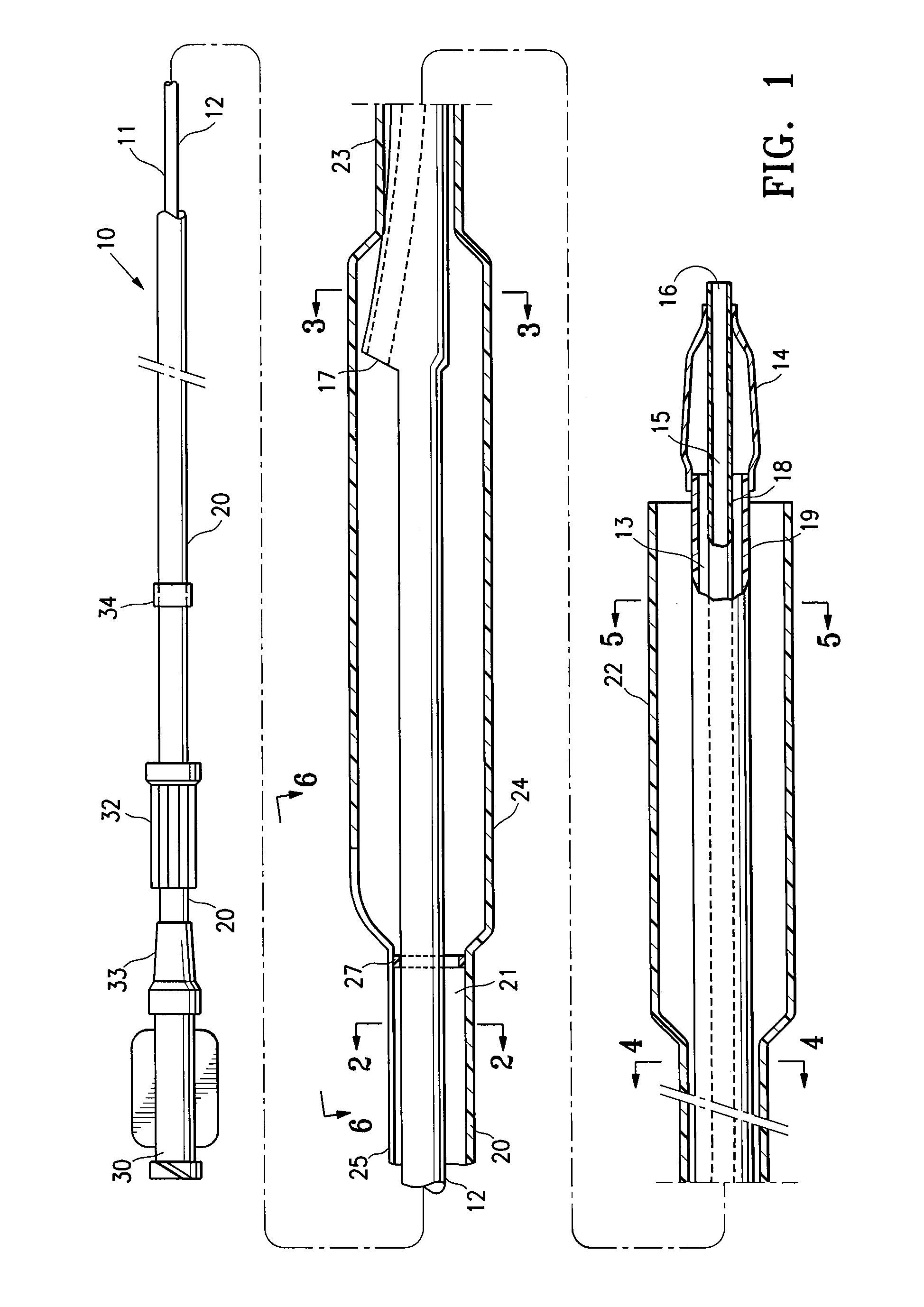 Highly trackable balloon catheter system and method for collapsing an expanded medical device